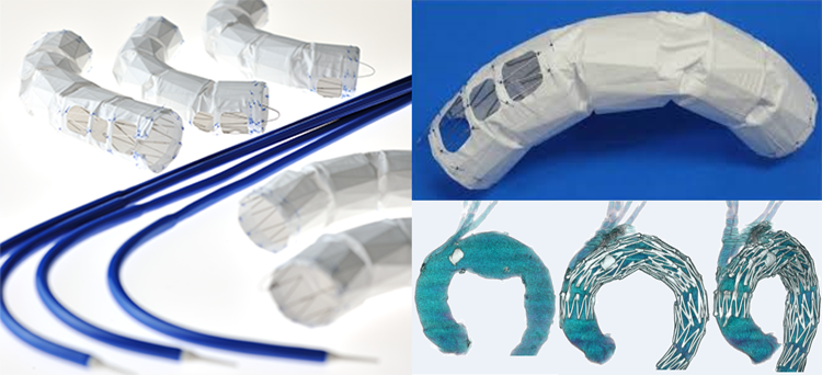 Najuta Thoracic Stent Graft System